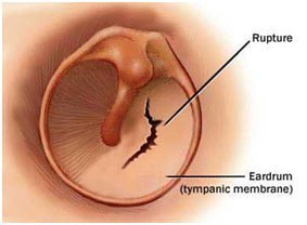 Hearing Aid Centre Chennai Outer Ear & Diseases Related To It 