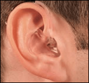 Hearing Aid Centre Chennai Types of Hearing aid  