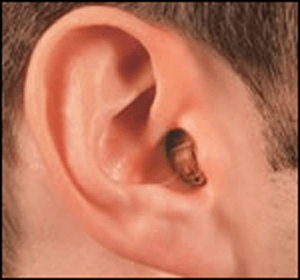 Hearing Aid Centre Chennai Types of Hearing aid  