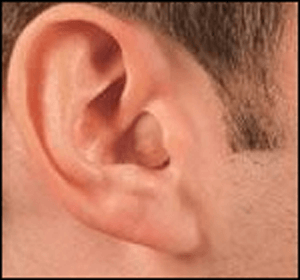 Hearing Aid Centre Chennai Types of Hearing aid  