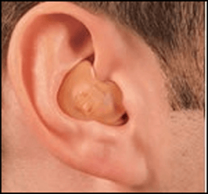 Hearing Aid Centre Chennai Types of Hearing aid  