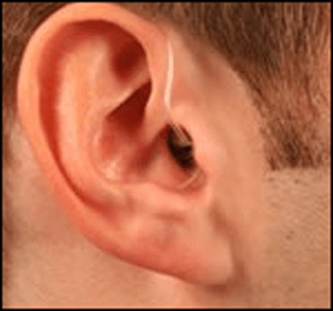 Hearing Aid Centre Chennai Types of Hearing aid 