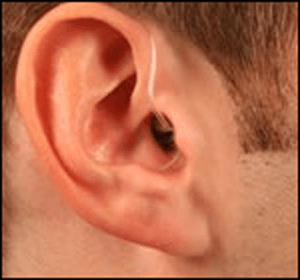 Hearing Aid Centre Chennai Types of Hearing aid  