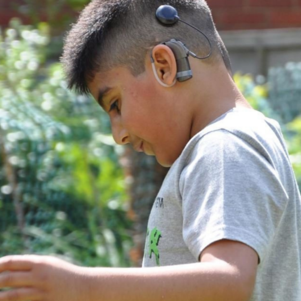 Hearing Aid Centre Chennai Cochlear implants for Kids & Adults  