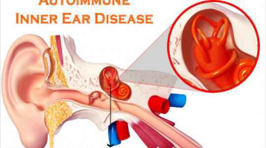Denoc Hearing Home Denoc Hearing Home Denoc Hearing Home Denoc Hearing Home Denoc Hearing Home Denoc Hearing Home Denoc Hearing Home Denoc Hearing Home Denoc Hearing Home Denoc Hearing Home Denoc Hearing Home Denoc Hearing Home Denoc Hearing Home Denoc Hearing Home
