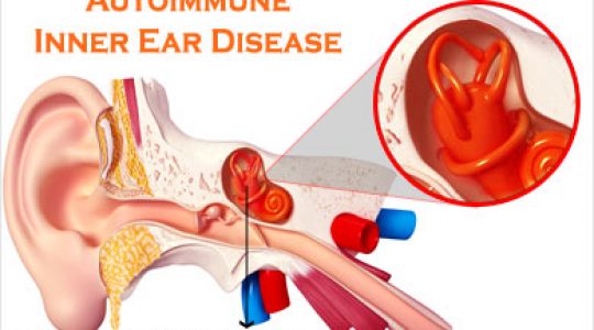 Hearing Aid Centre Chennai Home 